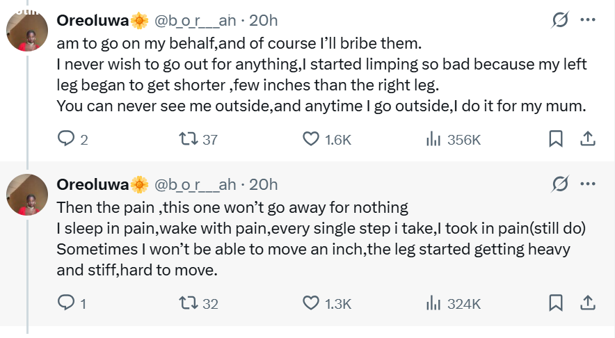 Whats worse than heartbreak?  Lady shares painful journey of living with hip condition